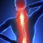Болевой синдром в области спины