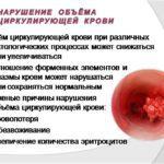 Уменьшение количества циркулирующей крови