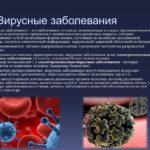 Вирусные и инфекционные заболевания