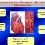 Заболевания сердца или сосудов